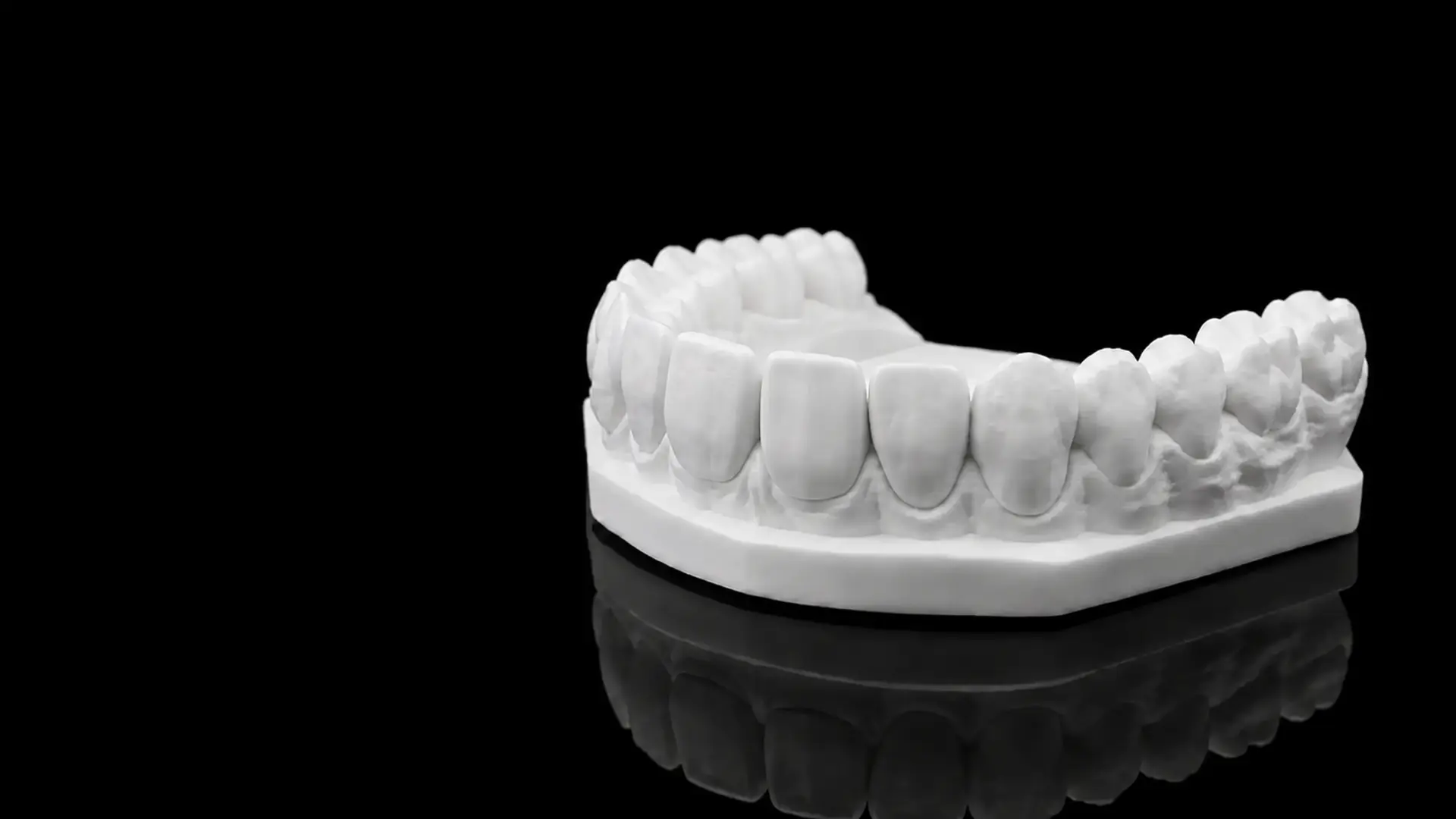 Dental Laboratory Roodepoort digital dental model
