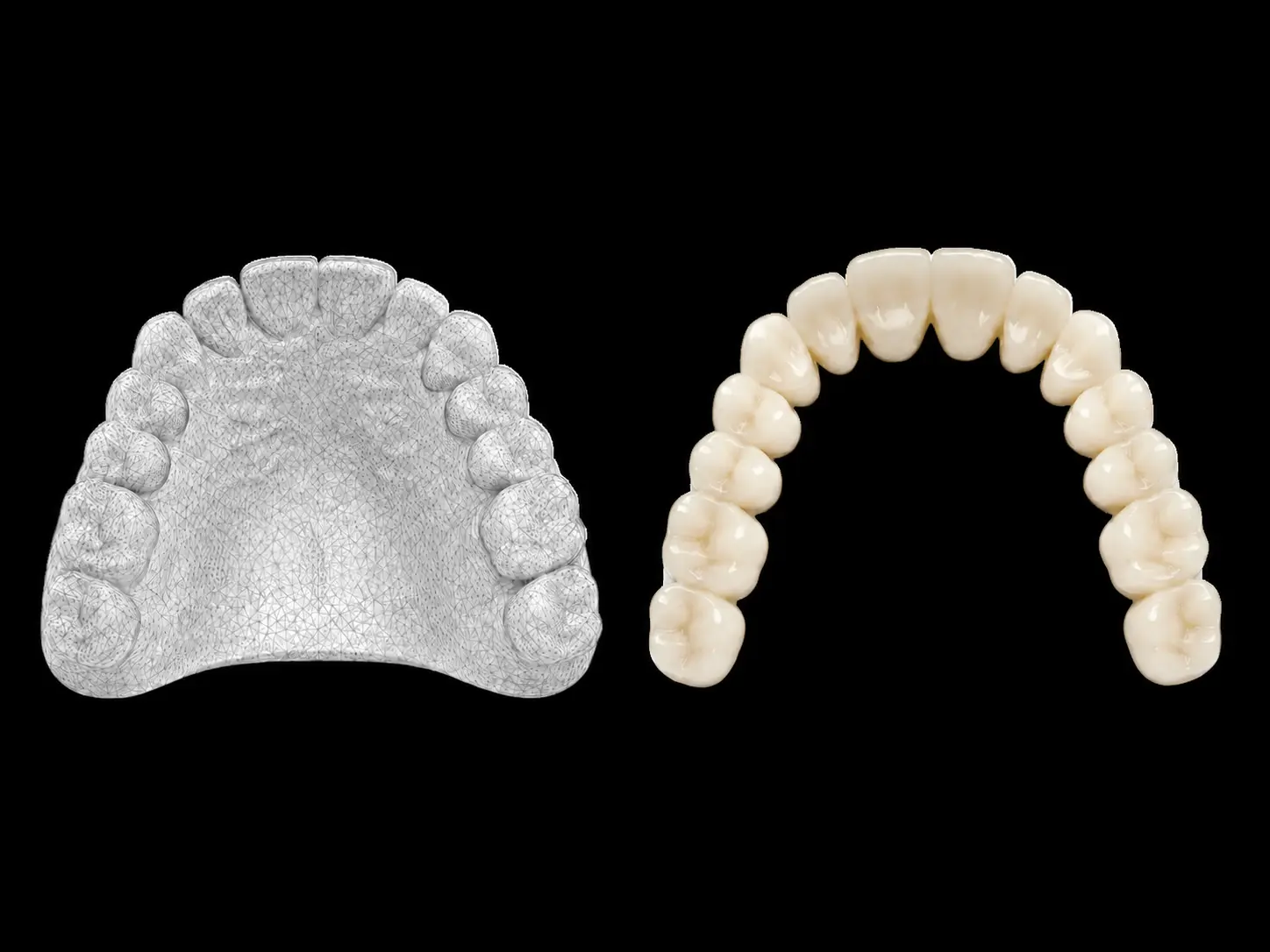 Digital dental scan and final restoration shown through a connected digital workflow